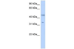 RDHE2 antibody used at 1 ug/ml to detect target protein. (SDR16C5 抗体  (Middle Region))