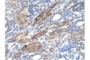 KIAA0319 antibody was used for immunohistochemistry at a concentration of 4-8 ug/ml to stain Epithelial cells of renal tubule (arrows) in Human Kidney. (KIAA0319 抗体  (N-Term))