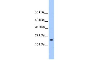WB Suggested Anti-C6orf173 Antibody Titration: 0. (CENPW 抗体  (N-Term))