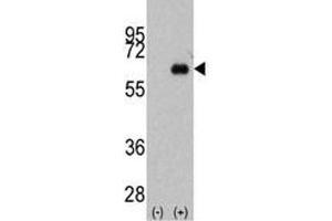 Western blot analysis of anti-Myc antibody and 293 cell lysate (2 ug/lane) either nontransfected (Lane 1) or transiently transfected with the MYC gene (2). (c-MYC 抗体  (AA 40-69))