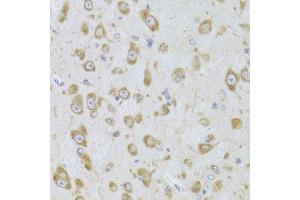 Immunohistochemistry of paraffin-embedded mouse brain using EEF1B2 Antibody.