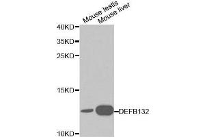 Western blot analysis of various cell lines using DEFB132 antibody. (DEFB132 抗体  (AA 1-95))