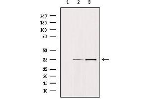 Western Blotting (WB) image for anti-Epithelial Cell Adhesion Molecule (EPCAM) (Internal Region) antibody (ABIN6265433)