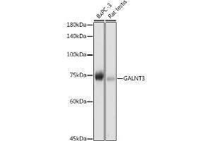 Western blot analysis of extracts of various cell lines, using G antibody (ABIN6131444, ABIN6140942, ABIN6140944 and ABIN6218180) at 1:1000 dilution. (GALNT3 抗体  (AA 1-140))