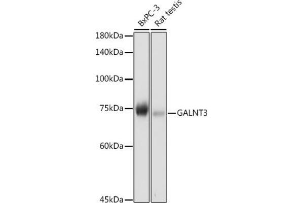 GALNT3 抗体  (AA 1-140)