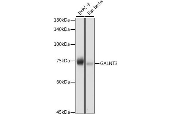 GALNT3 Antikörper  (AA 1-140)