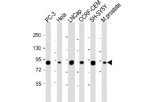 All lanes : Anti-TGM4 Antibody (Center) at 1:1000-1:2000 dilution Lane 1: PC-3 whole cell lysateLane 2: Hela whole cell lysate Lane 3: LNCap whole cell lysate Lane 4: CCRF-CEM whole cell lysate Lane 5: SH-SY5Y whole cell lysate Lane 6: Mouse prostate whole tissue lysate Lysates/proteins at 20 μg per lane. (TGM4 抗体  (AA 135-164))