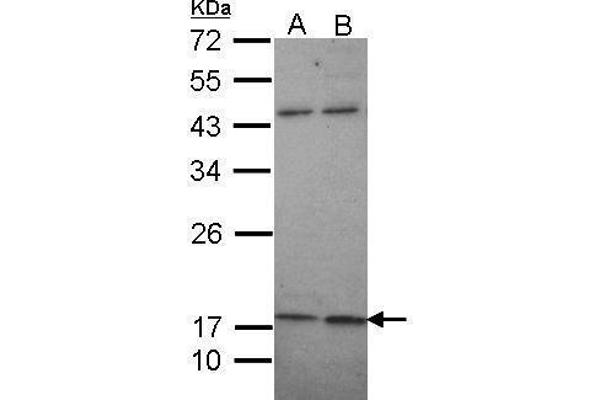 KCNMB1 antibody  (Center)