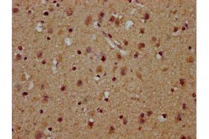 IHC image of ABIN7174180 diluted at 1:100 and staining in paraffin-embedded human brain tissue performed on a Leica BondTM system. (C16orf57 抗体  (AA 1-90))