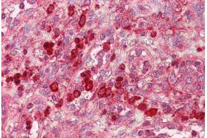 Anti-GZMB / Granzyme B antibody IHC staining of human spleen. (GZMB 抗体  (AA 10-59))