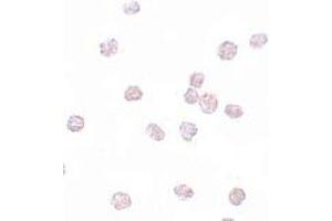 Immunohistochemistry (IHC) image for anti-SRY (Sex Determining Region Y)-Box 2 (SOX2) (N-Term) antibody (ABIN1031582) (SOX2 抗体  (N-Term))