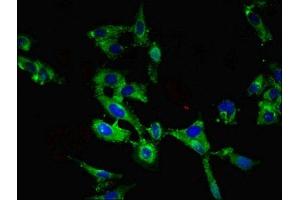 Immunofluorescence (IF) image for anti-Roundabout, Axon Guidance Receptor, Homolog 1 (ROBO1) (AA 29-143) antibody (ABIN7168440)