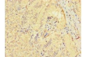 Immunohistochemistry of paraffin-embedded human adrenal gland tissue using ABIN7171870 at dilution of 1:100 (TSPAN32 抗体  (AA 111-202))