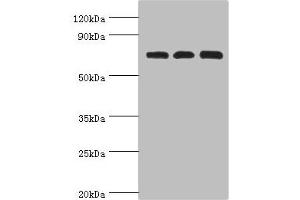 Western blot All lanes: Calcium-binding mitochondrial carrier protein Aralar2 antibody at 4 μg/mL Lane 1: Mouse liver tissue Lane 2: Mouse kidney tissue Lane 2: HepG2 whole cell lysate Secondary Goat polyclonal to rabbit IgG at 1/10000 dilution Predicted band size: 74 kDa Observed band size: 74 kDa (slc25a13 抗体  (AA 1-300))