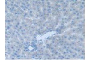 IHC-P analysis of Rat Liver Tissue, with DAB staining. (CEACAM1 抗体  (AA 36-145))
