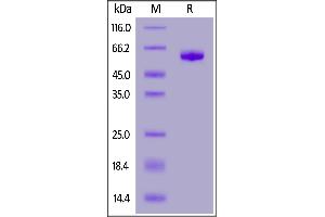 Human Siglec-15, Mouse IgG2a Fc Tag on  under reducing (R) condition. (SIGLEC15 Protein (AA 20-263) (Fc Tag))