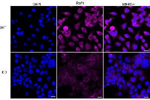 Immunocytochemical staining of HeLa cells using Raf1 antibody (ABIN7800800), 1:1,000), Top panel: wild-type (WT), Bottom panal: Raf1 shRNA knockdown (KD). (Recombinant RAF1 抗体)