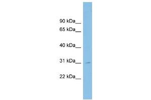 WB Suggested Anti-SPATA9 Antibody Titration: 0. (SPATA9 抗体  (N-Term))