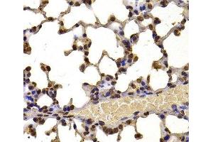 Immunohistochemistry of paraffin-embedded Mouse lung using WHSC1 Polyclonal Antibody at dilution of 1:100 (40x lens). (WHSC1 抗体)