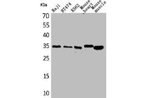 Western Blot analysis of Raji BT474 K562 mouse heart mouse skeletal muscle cells using Claudin-17 Polyclonal Antibody (Claudin 17 抗体  (C-Term))