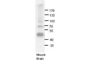ADARB1 antibody - N-terminal region  validated by WB using Mouse brains at 1:1000. (RED1 抗体  (N-Term))