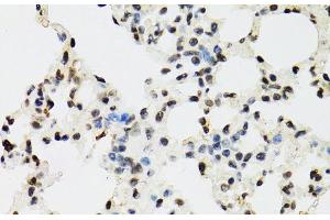 Immunohistochemistry of paraffin-embedded Mouse lung using EDF1 Polyclonal Antibody at dilution of 1:100 (40x lens). (EDF1 抗体)