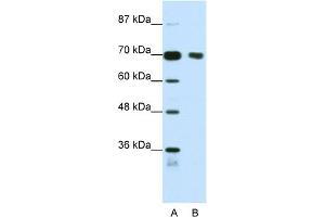 WB Suggested Anti-TRIM32 Antibody Titration:  1. (TRIM32 抗体  (N-Term))