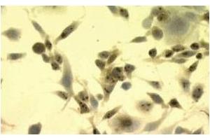 Immunohistochemistry (IHC) image for anti-Heat Shock Protein 70 (HSP70) antibody (ABIN263937) (HSP70 抗体)