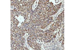 IHC analysis of PAH using anti-PAH antibody (ABIN5518942).