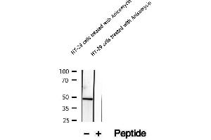 Western blot analysis of extracts of HT-29 cells treated with Anisomycin, using Phospho-Keratin 20 (Ser13) Antibody.