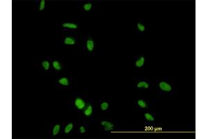 Immunofluorescence of monoclonal antibody to CCNH on HeLa cell. (Cyclin H 抗体  (AA 1-110))