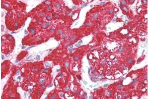 Immunohistochemistry (IHC) image for anti-Activin Receptor Type 1C (ACVR1C) (N-Term) antibody (ABIN1099825)