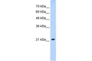 Western Blotting (WB) image for anti-Solute Carrier Family 25 (Mitochondrial Carrier, Brain), Member 14 (SLC25A14) antibody (ABIN2462743) (SLC25A14 抗体)