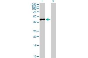 Western Blot analysis of MAGEA3 expression in transfected 293T cell line by MAGEA3 MaxPab polyclonal antibody. (MAGEA3 抗体  (AA 1-314))