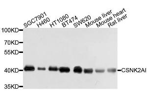 Western blot analysis of extracts of various cell lines, using CSNK2A1 antibody. (CSNK2A1/CK II alpha 抗体  (AA 1-391))
