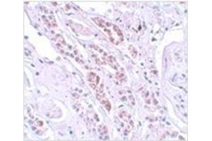 Immunohistochemistry of TCTN1 in human kidney tissue with TCTN1 antibody at 5 μg/ml. (TCTN1 抗体  (N-Term))