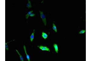 Immunofluorescent analysis of U251 cells using ABIN7149746 at dilution of 1:100 and Alexa Fluor 488-congugated AffiniPure Goat Anti-Rabbit IgG(H+L) (DSE 抗体  (AA 23-270))