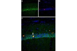Immunohistochemistry (IHC) image for anti-Sodium Channel, Voltage-Gated, Type VIII, alpha (SCN8A) (AA 1042-1061) antibody (ABIN7043651)