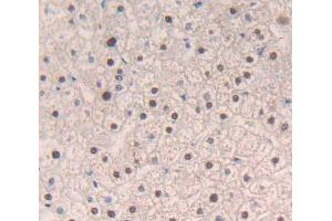 IHC-P analysis of Human Tissue, with DAB staining. (NR1H3 抗体  (AA 95-434))