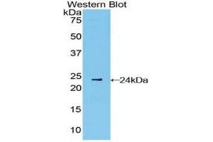Western Blotting (WB) image for anti-Interferon, beta 1, Fibroblast (IFNB1) (AA 22-187) antibody (ABIN3209026) (IFNB1 抗体  (AA 22-187))