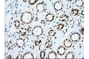 Immunohistochemical staining of paraffin-embedded Human thyroid tissue using anti-TTC32 mouse monoclonal antibody. (TTC32 抗体)
