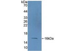 Detection of Recombinant CF6, Human using Polyclonal Antibody to Coupling Factor 6 (CF6) (ATP5J 抗体  (AA 1-108))
