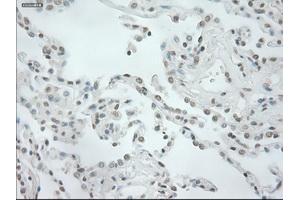 Immunohistochemical staining of paraffin-embedded prostate tissue using anti-NEUROG1mouse monoclonal antibody. (Neurogenin 1 抗体)