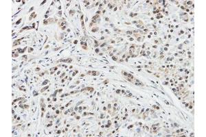 IHC-P Image Immunohistochemical analysis of paraffin-embedded A549 xenograft, using DUSP10, antibody at 1:100 dilution. (DUSP10 抗体  (C-Term))