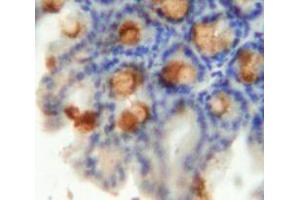 Used in DAB staining on fromalin fixed paraffin-embedded Intestine tissue (Emilin1 抗体  (AA 806-1016))