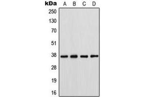 Western blot analysis of Connexin 37 expression in HeLa (A), SW620 (B), A431 (C), NIH3T3 (D) whole cell lysates. (GJA4 抗体  (Center))