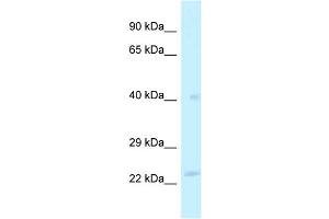WB Suggested Anti-MRPL40 Antibody Titration: 1.