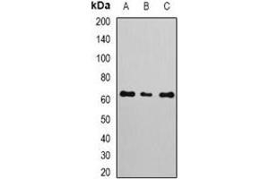Western blot analysis of NERF expression in A549 (A), MCF7 (B), Jurkat (C) whole cell lysates. (ELF2 抗体)