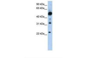 Image no. 1 for anti-Transmembrane Protein 38B (TMEM38B) (C-Term) antibody (ABIN6738352) (TMEM38B 抗体  (C-Term))