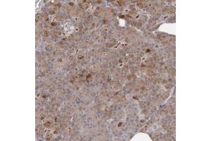 Immunohistochemical staining of human pancreas with ANKRD44 polyclonal antibody  shows moderate cytoplasmic positivity in exocrine cells. (ANKRD44 抗体)